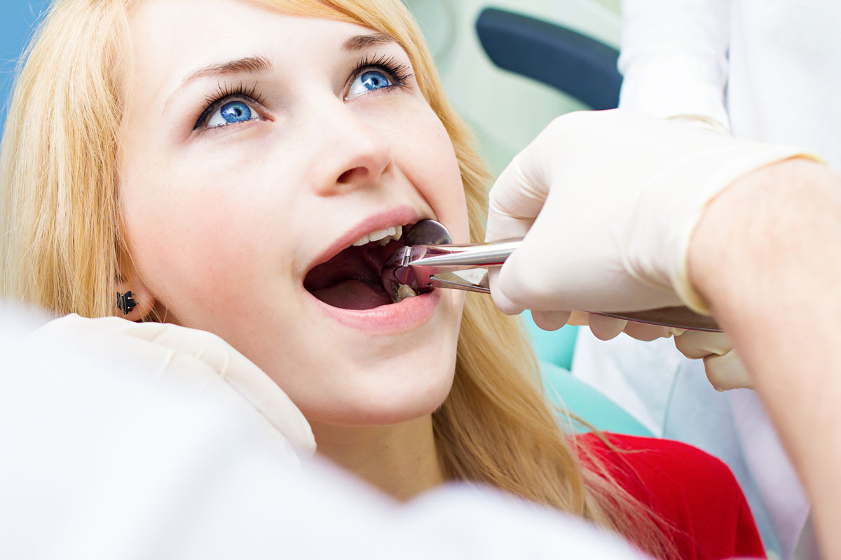 What You Can Expect After a Tooth Extraction